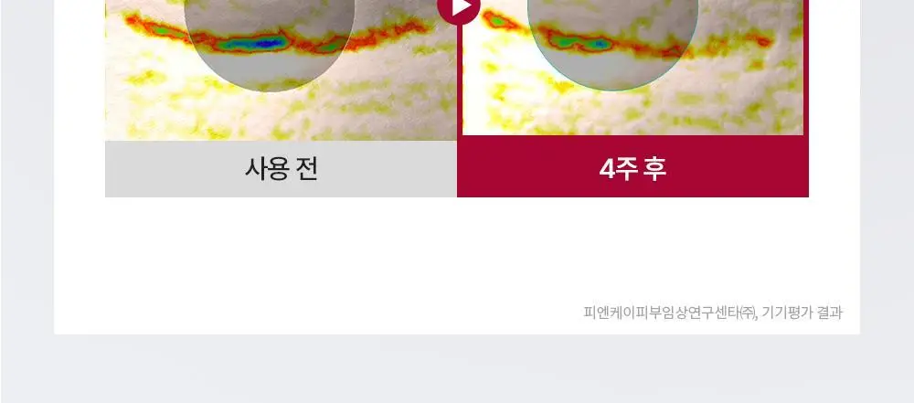 [5월 올영픽/1등 세럼] 유세린 하이알루론 에피셀린 세럼 30ml 기획 (+에피셀린 세럼 7ml*2) 상세페이지 25
